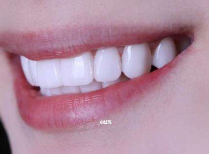 http://www.bstoo.cn/d/file/news/d51nul4c8cjv.jpg