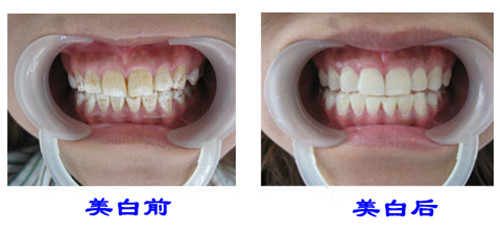 http://www.bstoo.cn/d/file/price/0957048116.jpg