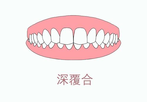http://www.bstoo.cn/d/file/price/0YGPLW5K03.jpg