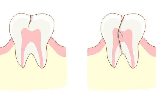 http://www.bstoo.cn/d/file/price/0m9zpeb47xnb.jpg