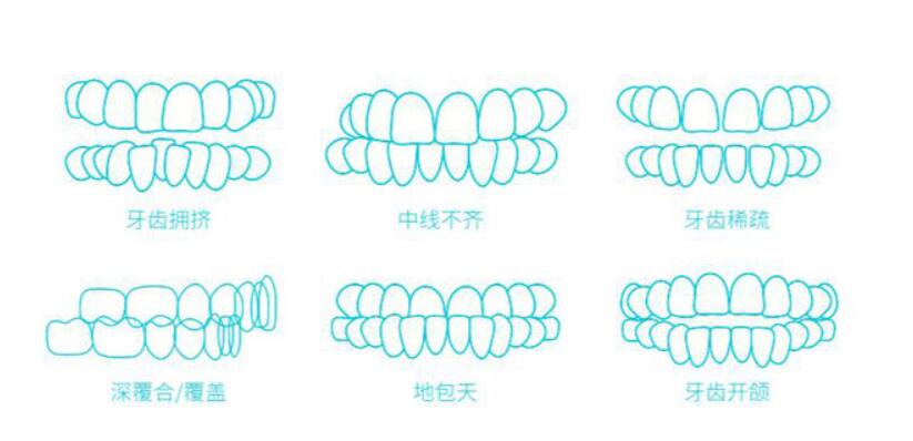 http://www.bstoo.cn/d/file/price/0p8xa8cbe5po.jpg