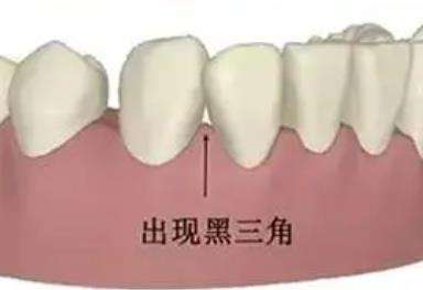 http://www.bstoo.cn/d/file/price/10w8iyj06ayz.jpg