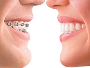 http://www.bstoo.cn/d/file/price/1113023886.jpg