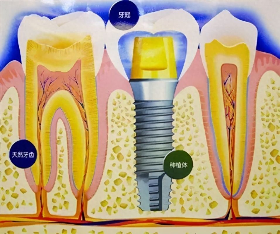 http://www.bstoo.cn/d/file/price/11wpx8lt46.jpg