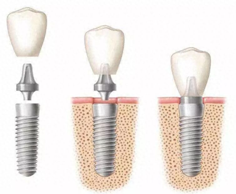 http://www.bstoo.cn/d/file/price/12mg6sl403pu.jpg
