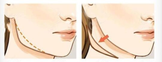 http://www.bstoo.cn/d/file/price/2472ONFHPK.jpg