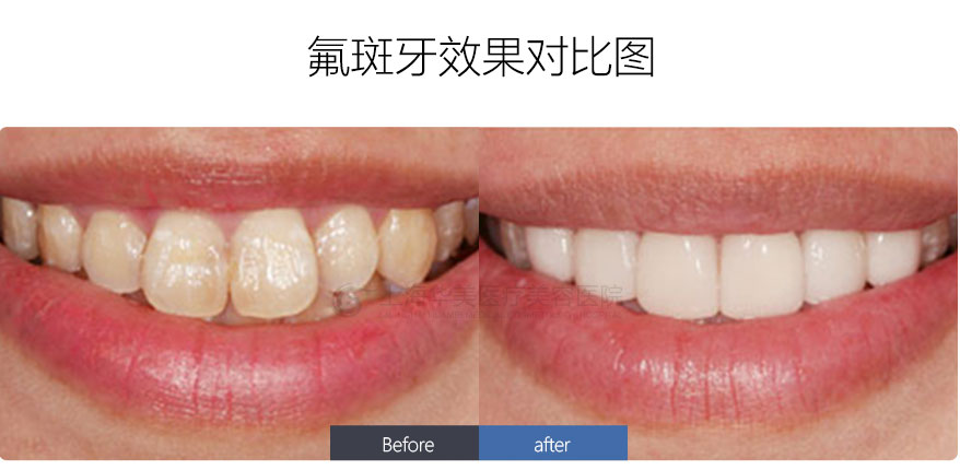 http://www.bstoo.cn/d/file/price/2SNFYPASP2.jpg