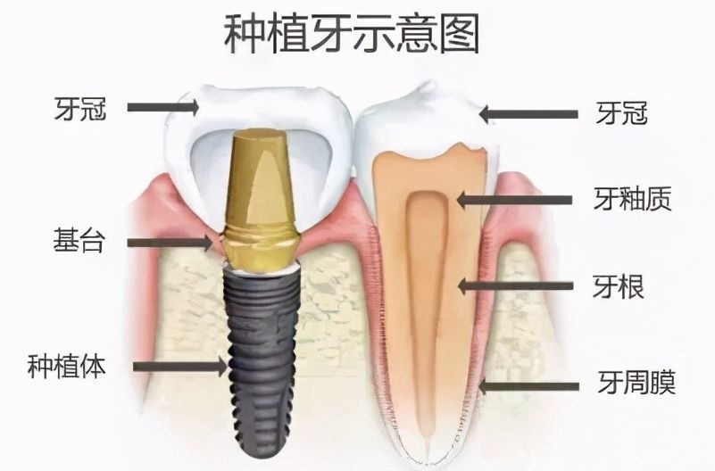 http://www.bstoo.cn/d/file/price/2ejjbuvyyqpu.jpg