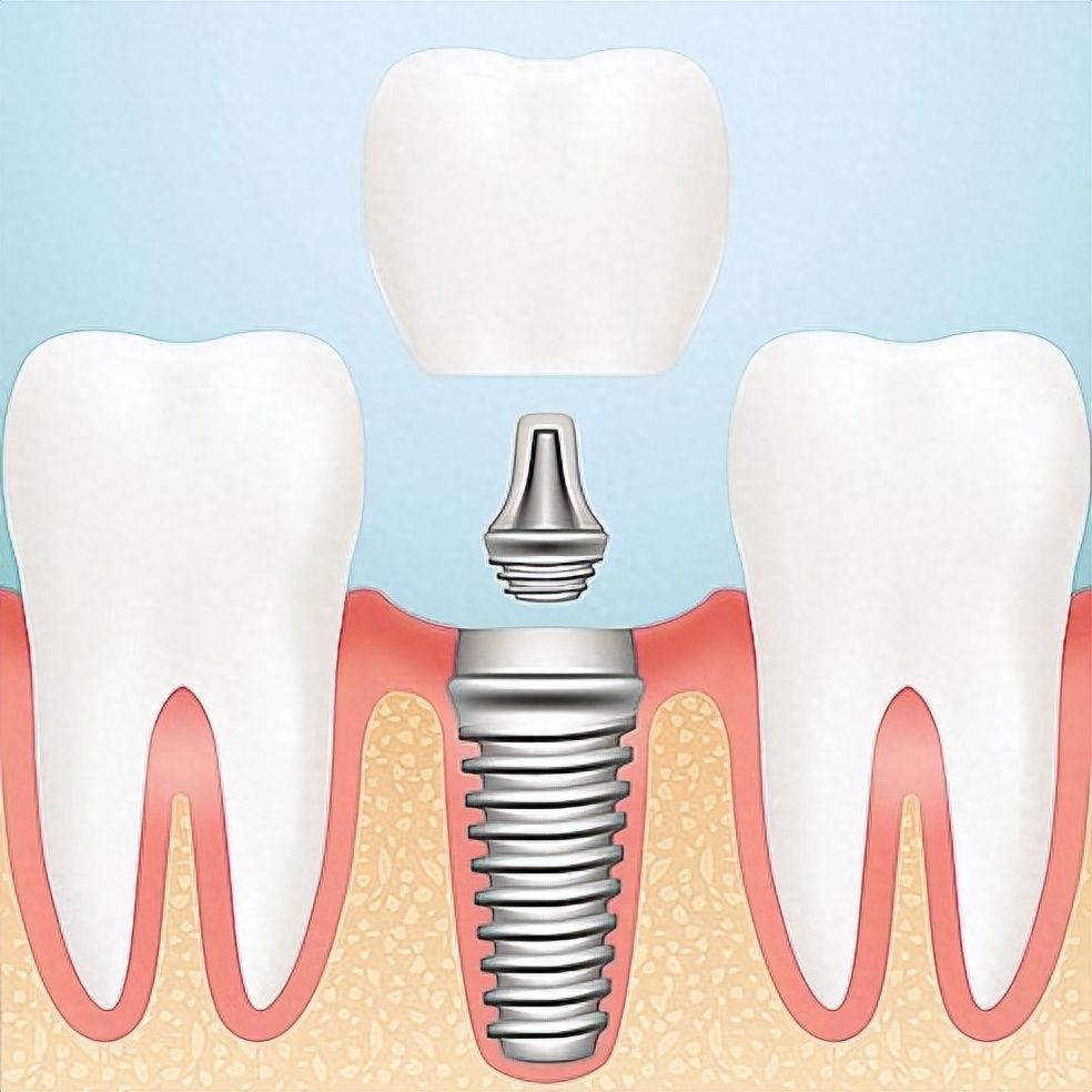 http://www.bstoo.cn/d/file/price/2pqx40w2m8xv.jpg