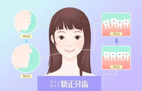 汕頭第二人民醫(yī)院口腔科口碑評價(jià)及牙齒正畸價(jià)格表