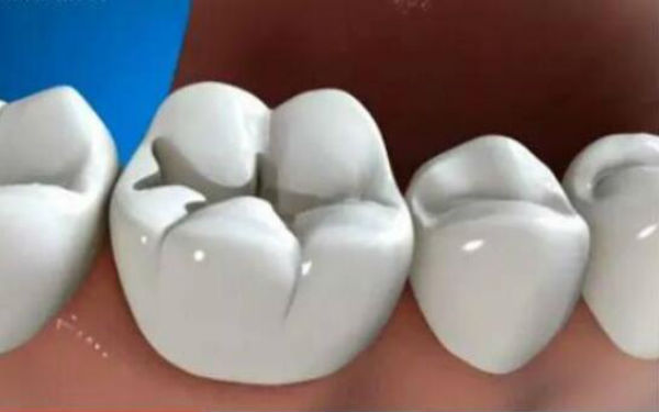 http://www.bstoo.cn/d/file/price/3BR2AU52T3.jpg