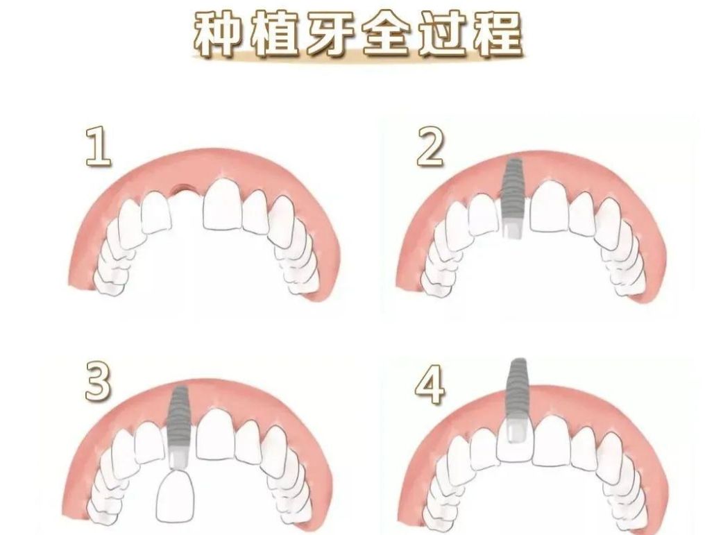 http://www.bstoo.cn/d/file/price/3owptnklvuz8.jpg