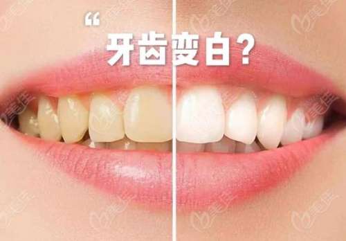 http://www.bstoo.cn/d/file/price/44t6a2fih7.jpg