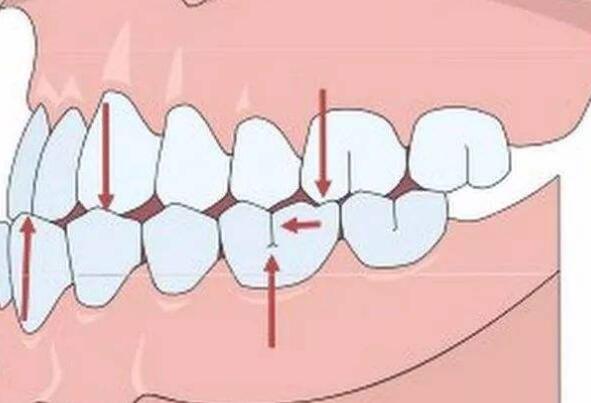 http://www.bstoo.cn/d/file/price/5jh5i3d7gy.jpg
