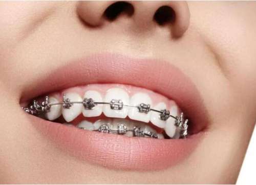 http://www.bstoo.cn/d/file/price/5kaqymaqt8q1.jpg