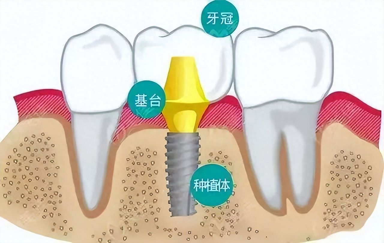 http://www.bstoo.cn/d/file/price/5t8nai1au2.jpg
