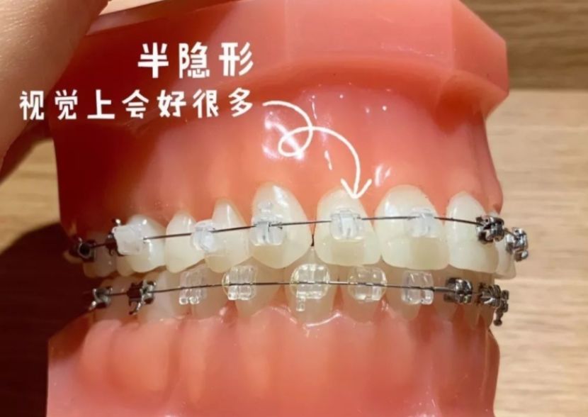 http://www.bstoo.cn/d/file/price/6fl7es2blbjk.jpg