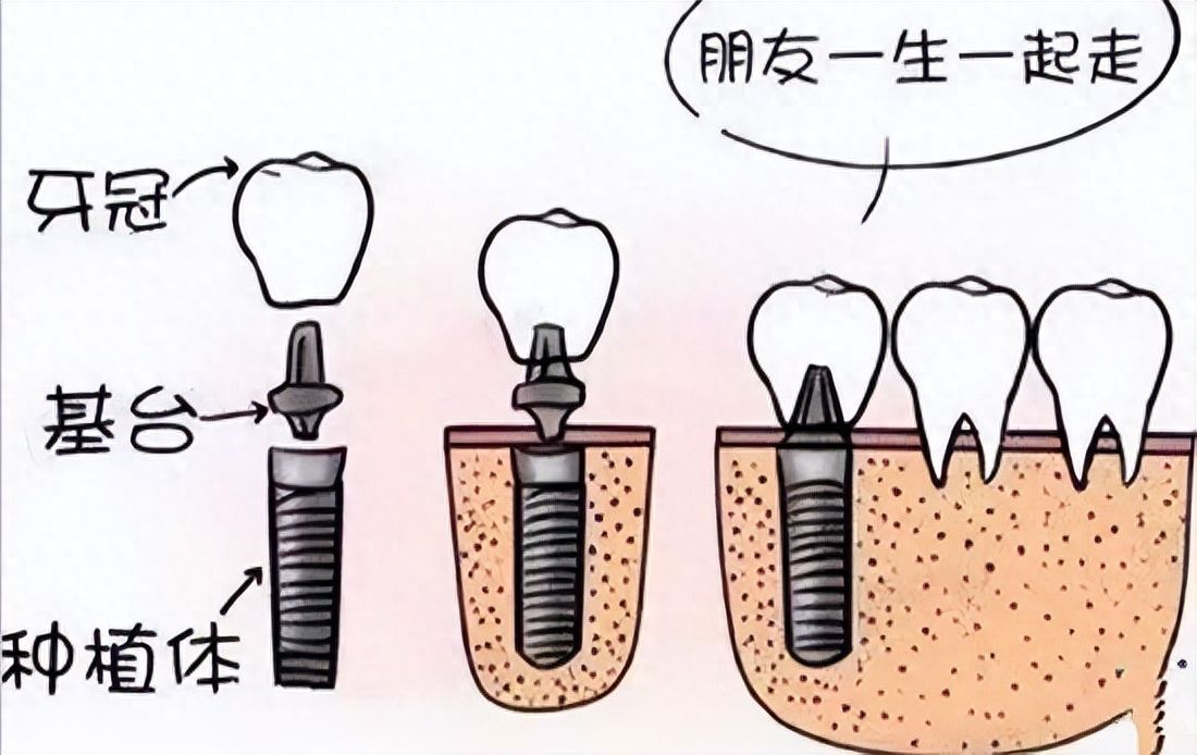 http://www.bstoo.cn/d/file/price/6mehgt4moysk.jpg