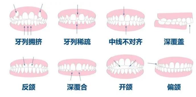 http://www.bstoo.cn/d/file/price/6mlk8axzr7fe.jpg