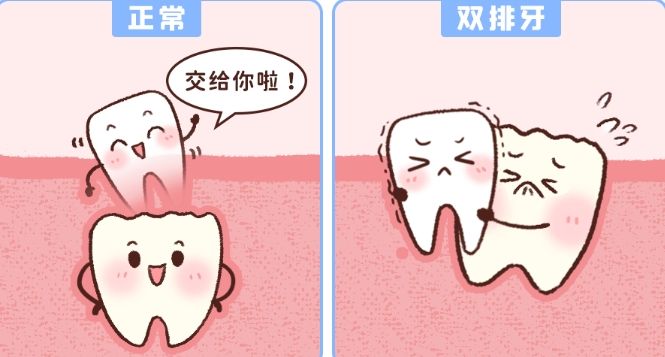 4月26日起，福建單顆種牙價(jià)格直降50%