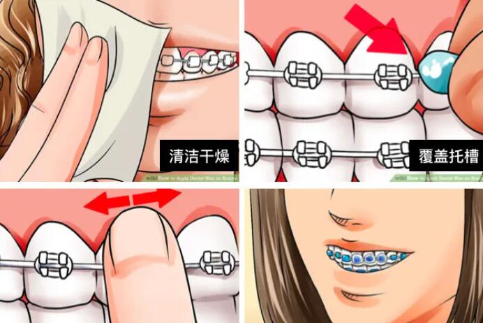 http://www.bstoo.cn/d/file/price/77arkoqe0odu.jpg