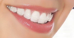 http://www.bstoo.cn/d/file/price/7BPV5IHZBT.jpg