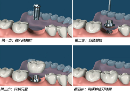 http://www.bstoo.cn/d/file/price/7a5muxe46z.jpg