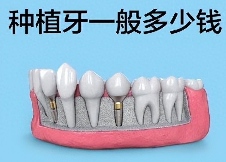 http://www.bstoo.cn/d/file/price/7ku3gknwxrj4.jpg