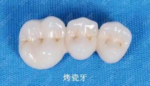 http://www.bstoo.cn/d/file/price/88f2rnv8vqt8.jpg