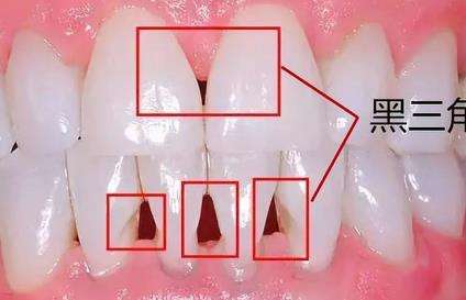 http://www.bstoo.cn/d/file/price/8dk0btm3ak.jpg