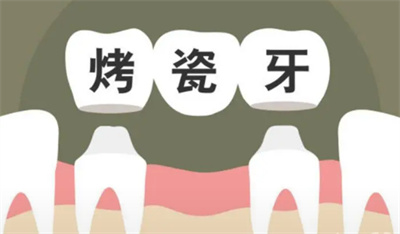 http://www.bstoo.cn/d/file/price/8j5b1s85vj0w.jpg