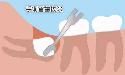 http://www.bstoo.cn/d/file/price/8ycalpg5tj5t.jpg