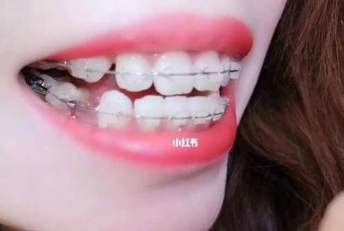http://www.bstoo.cn/d/file/price/9k6wrry834i9.jpg