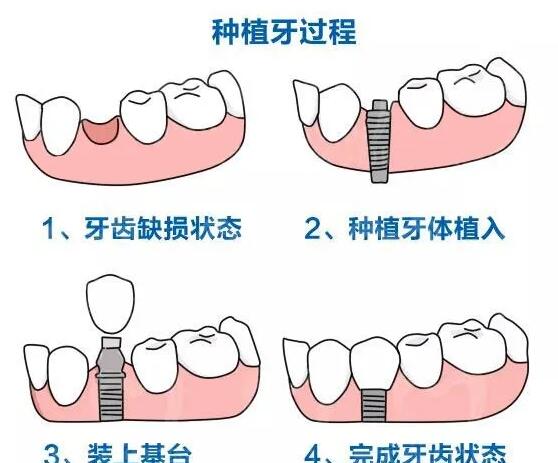 http://www.bstoo.cn/d/file/price/AOS55SBEP7.jpg