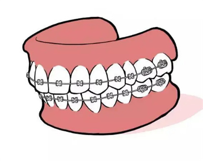 http://www.bstoo.cn/d/file/price/CPL62SR2S5.jpg