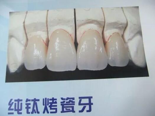 http://www.bstoo.cn/d/file/price/FG5BDPOW4G.jpg