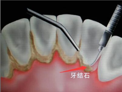 http://www.bstoo.cn/d/file/price/G156PQRXB2.jpg
