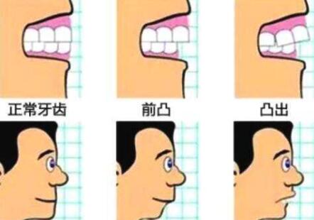 http://www.bstoo.cn/d/file/price/GL3XS5JNF5.jpg