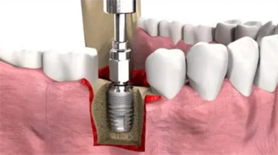 http://www.bstoo.cn/d/file/price/GMBGIT6CIG.jpg