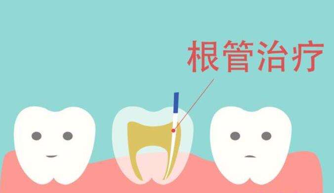 http://www.bstoo.cn/d/file/price/IEGOBCLII9.jpg