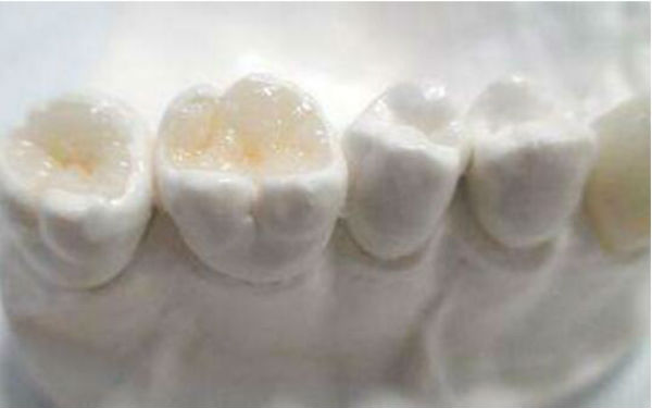http://www.bstoo.cn/d/file/price/IZ2069I9TF.jpg