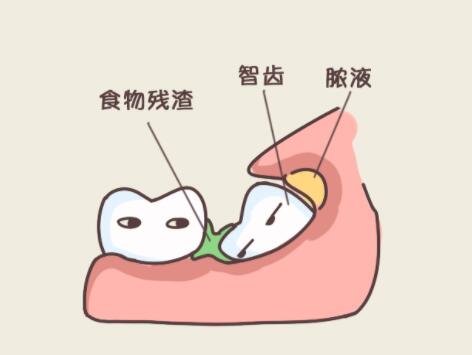 http://www.bstoo.cn/d/file/price/M5RIJLRXF2.jpg