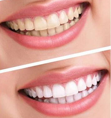 http://www.bstoo.cn/d/file/price/S60D0JJK9W.jpg