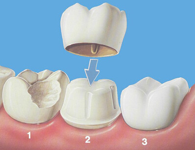 http://www.bstoo.cn/d/file/price/UQ0AC6PLDA.jpg