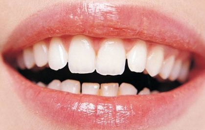 http://www.bstoo.cn/d/file/price/UZA57HXCG2.jpg