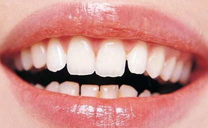 http://www.bstoo.cn/d/file/price/VG5WA1HUKT.jpg