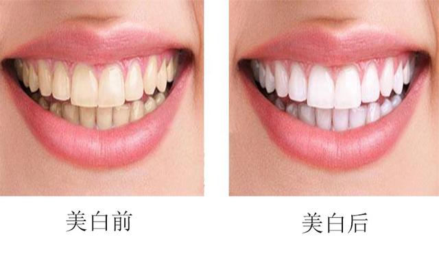 http://www.bstoo.cn/d/file/price/VXXHD6Y7XI.jpg