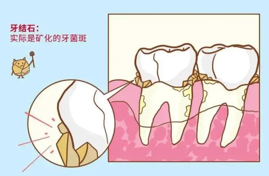 http://www.bstoo.cn/d/file/price/WBM0CUSI4A.jpg