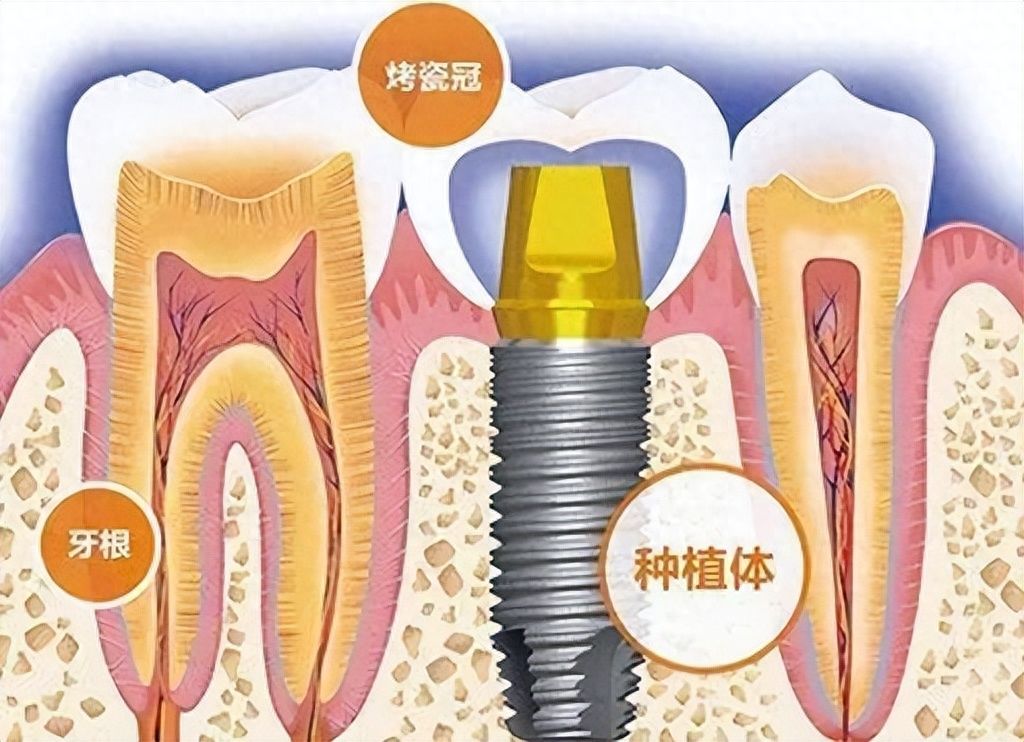 http://www.bstoo.cn/d/file/price/a5l9q2rrwq3p.jpg