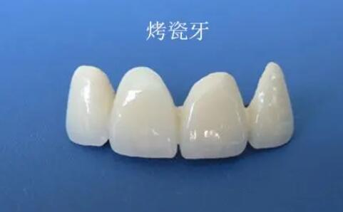 http://www.bstoo.cn/d/file/price/avyobiy1a0kv.jpg